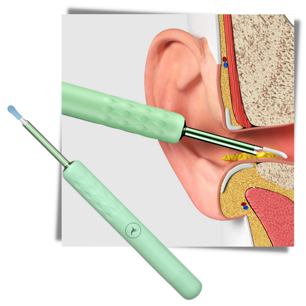 Cure Oreille Intelligent