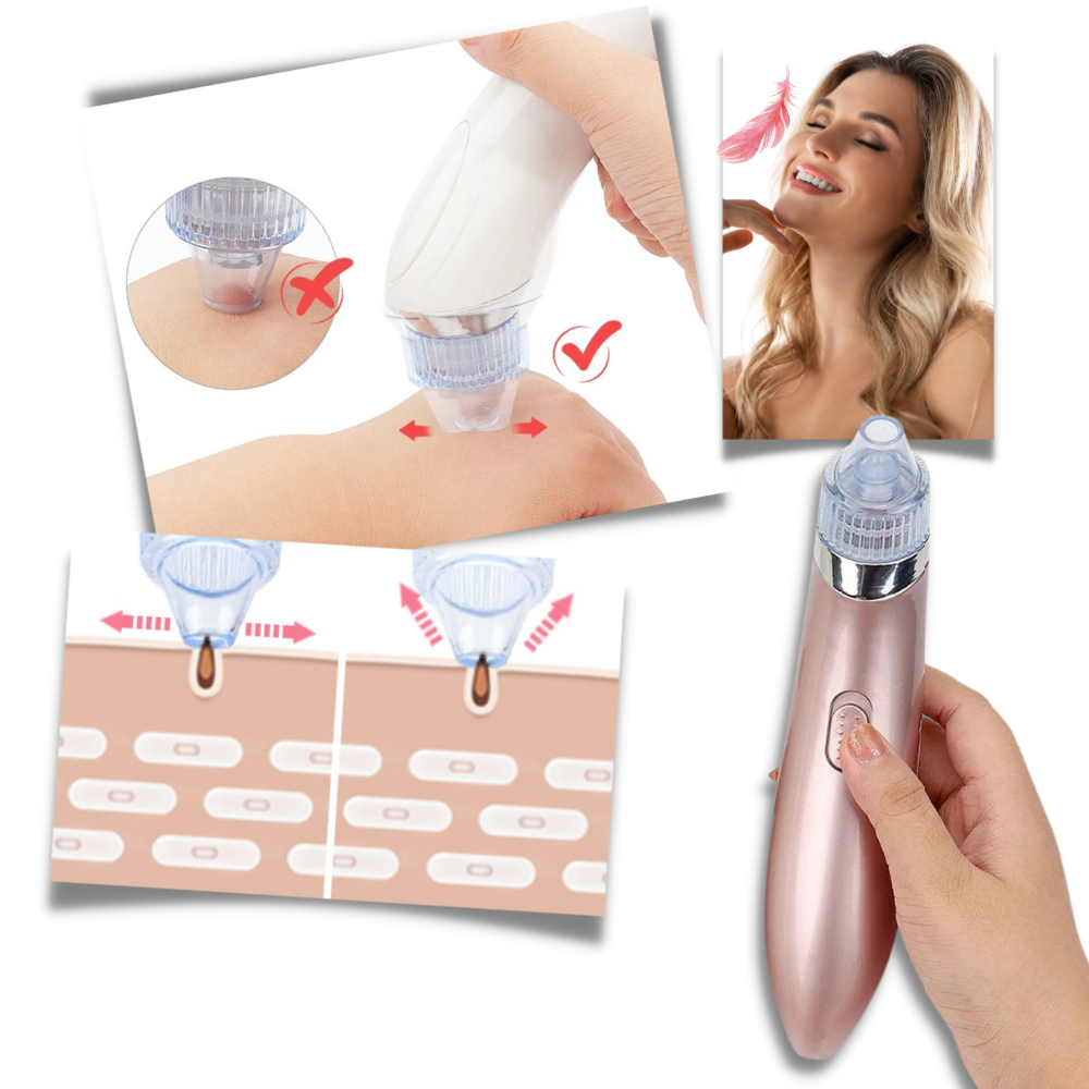 Aspirateur de points noirs du visage