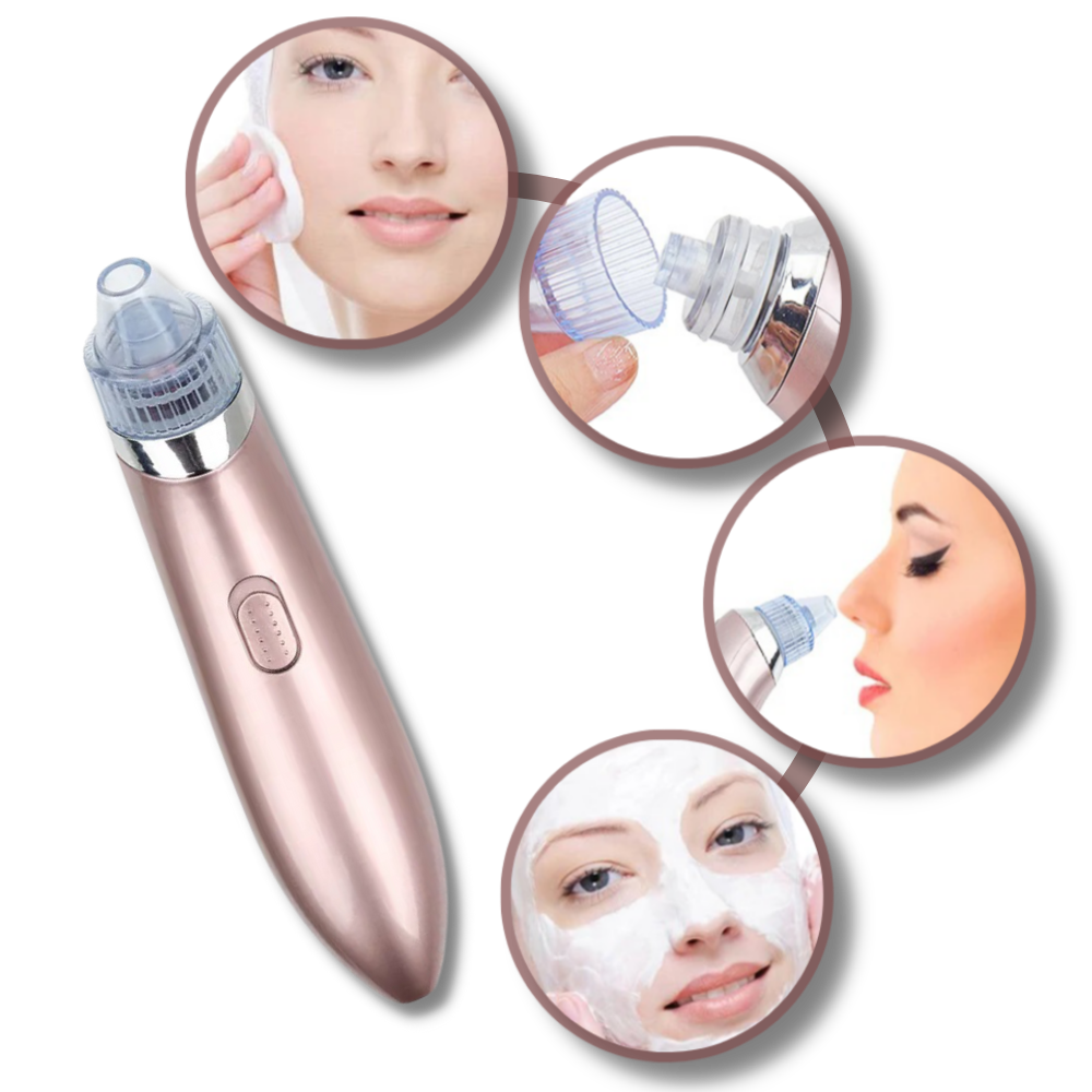 Aspirateur de points noirs du visage