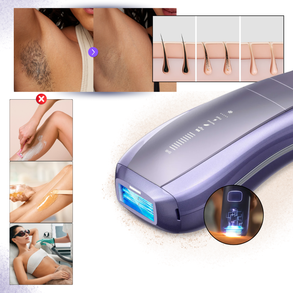 Appareil d'épilation laser
